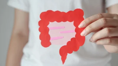 Colitis