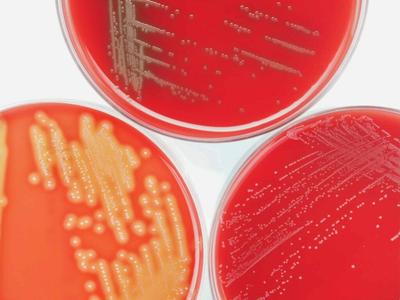 Researchers Map Three-Phase Path to Move Microbial Protein Into the Mainstream