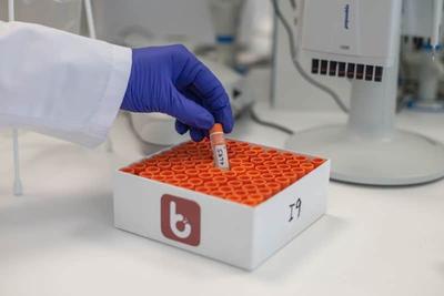 Bene Meat Researchers Publish Cultivated Meat Safety Review, Rejecting Cancer Cell Comparisons